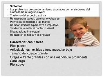 Imagen de Diego con información sobre el X frágil 