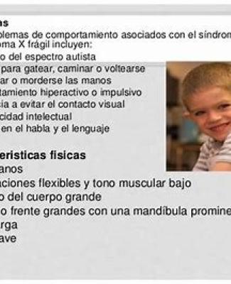 Imagen de Diego con información sobre el X frágil 